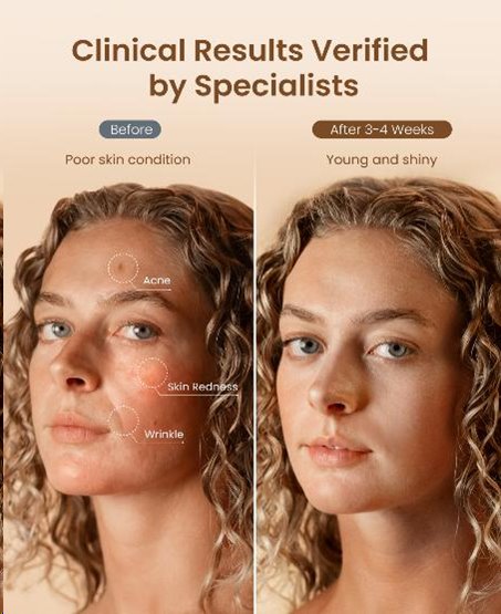 Renpho Rejuven Artemis Blush LED Light Therapy Mask, 432 vysokohustých LED diód, 4 svetelné režimy,5 úrovní intenzity